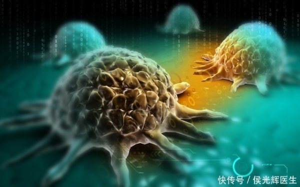 上上策 久坐时间致癌风险？哈佛发现：每天久坐超8小时肺癌风险升18%